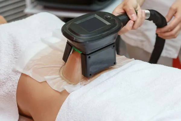 Image of person having fat freezing treatment to help weight gain Banbury