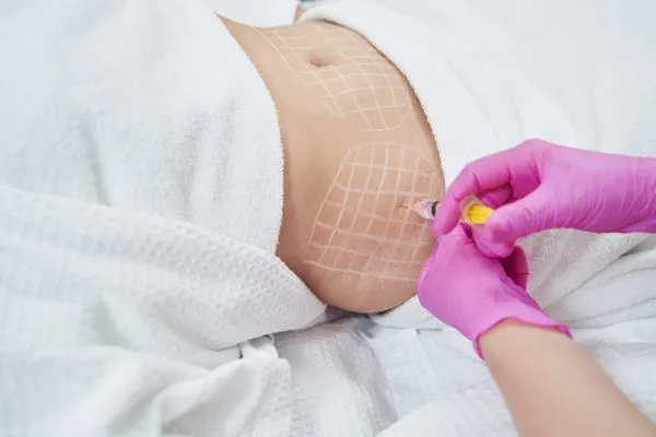 image of fat dissolving injections on love handles to help combat weight gain Banbury
