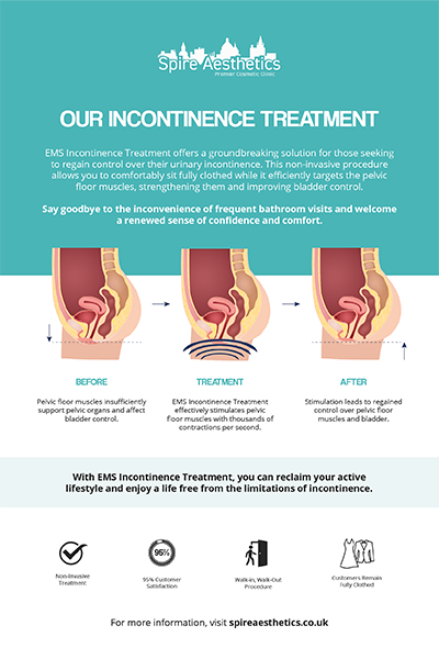 image to show how EMS treatment works for female urinary incontinence Banbury