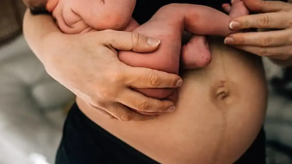 Why Is My Stomach Still Big After Pregnancy Banbury?