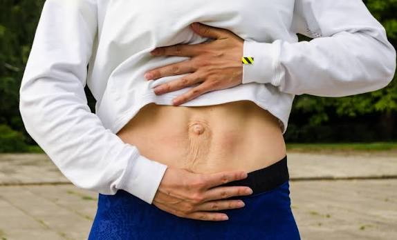 When Could Diastasis Recti Be the Missing Piece of the Puzzle Banbury?